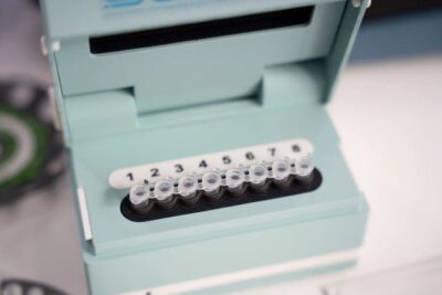 ВНИИЗЖ разработал отечественный тест для быстрой диагностики опасной инфекции у КРС